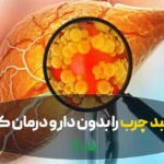 کبد چرب و راه های درمان خانگی